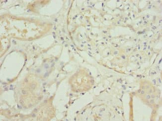 Polyclonal Rabbit anti-Human RP2 Antibody (IHC, IF)
