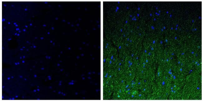 NEFM / NF-M Antibody (clone RMO 14.9)