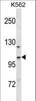 CC2D1A Antibody (aa143-172)