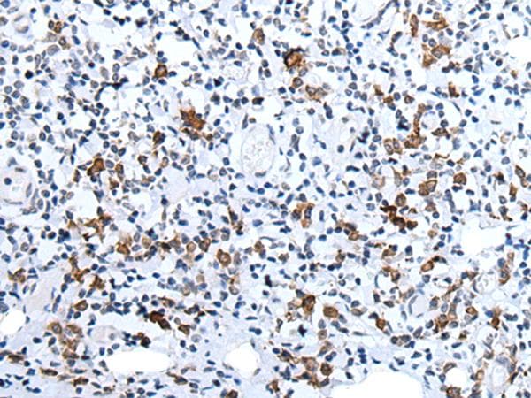 HCRT / Orexin Antibody