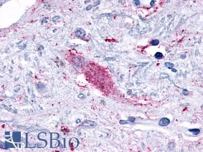 PathPlus™ ADGRF5 / GPR116 Antibody (N-Terminus)