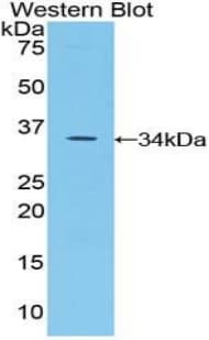 SPINK5 / LEKTI Antibody (aa734-995)