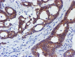 ERBB2 / HER2 Antibody (aa676-1255, clone OTI11A7, Carrier-free)