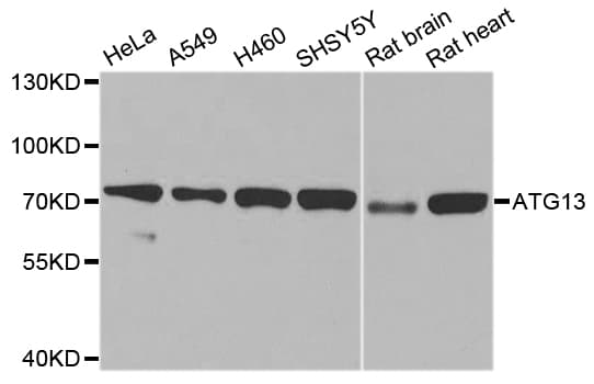 KIAA0652 / ATG13 Antibody