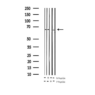 FOXO4 / AFX1 Antibody (phospho-Ser197)