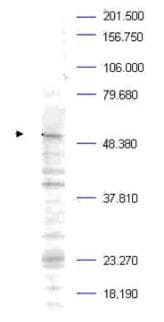 IHC-plus™ Polyclonal Rabbit anti-Human PLK1 / PLK-1 Antibody (phospho-Thr210, IHC, WB)