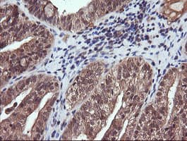 PIK3CG / PI3K Gamma Antibody (clone OTI6H5)