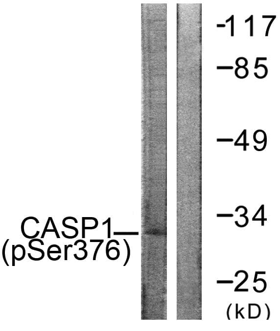 CASP1 / Caspase 1 Antibody (phospho-Ser376)