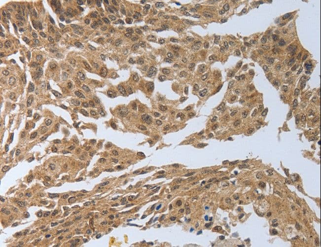 Polyclonal Rabbit anti-Human PSMD6 Antibody (IHC, WB)