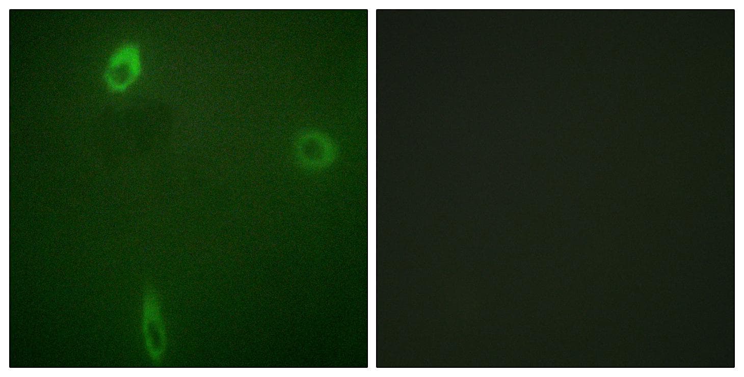 Polyclonal Rabbit anti-Human KCNJ1 / ROMK Antibody (phospho-Ser44/25, IHC, IF)