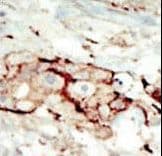 FGFR2 / FGF Receptor 2 Antibody (aa22-51)