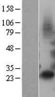 IGFBP1 Protein (Over-Expression Lysate Myc-DDK (Flag))