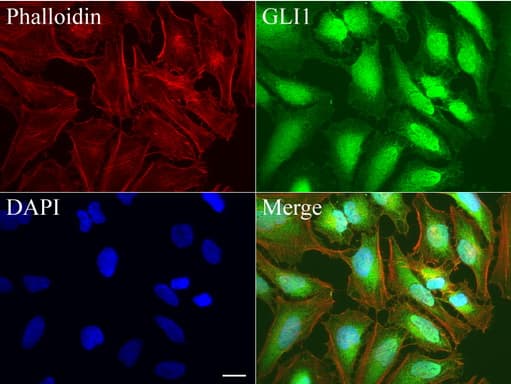 GLI / GLI1 Antibody (aa1-410, clone UMAB170)