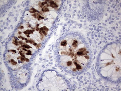 TAG-72 Antibody (clone B72)