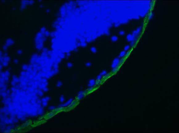 IHC-plus™ KRT19 / CK19 / Cytokeratin 19 Antibody (clone RCK108)