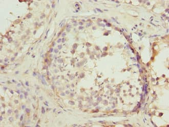 Polyclonal Rabbit anti-Human PTPRE / PTP Epsilon Antibody (IHC, WB)