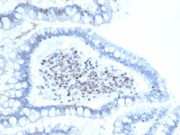 BMI1 / PCGF4 Antibody (clone BMI1/2689)