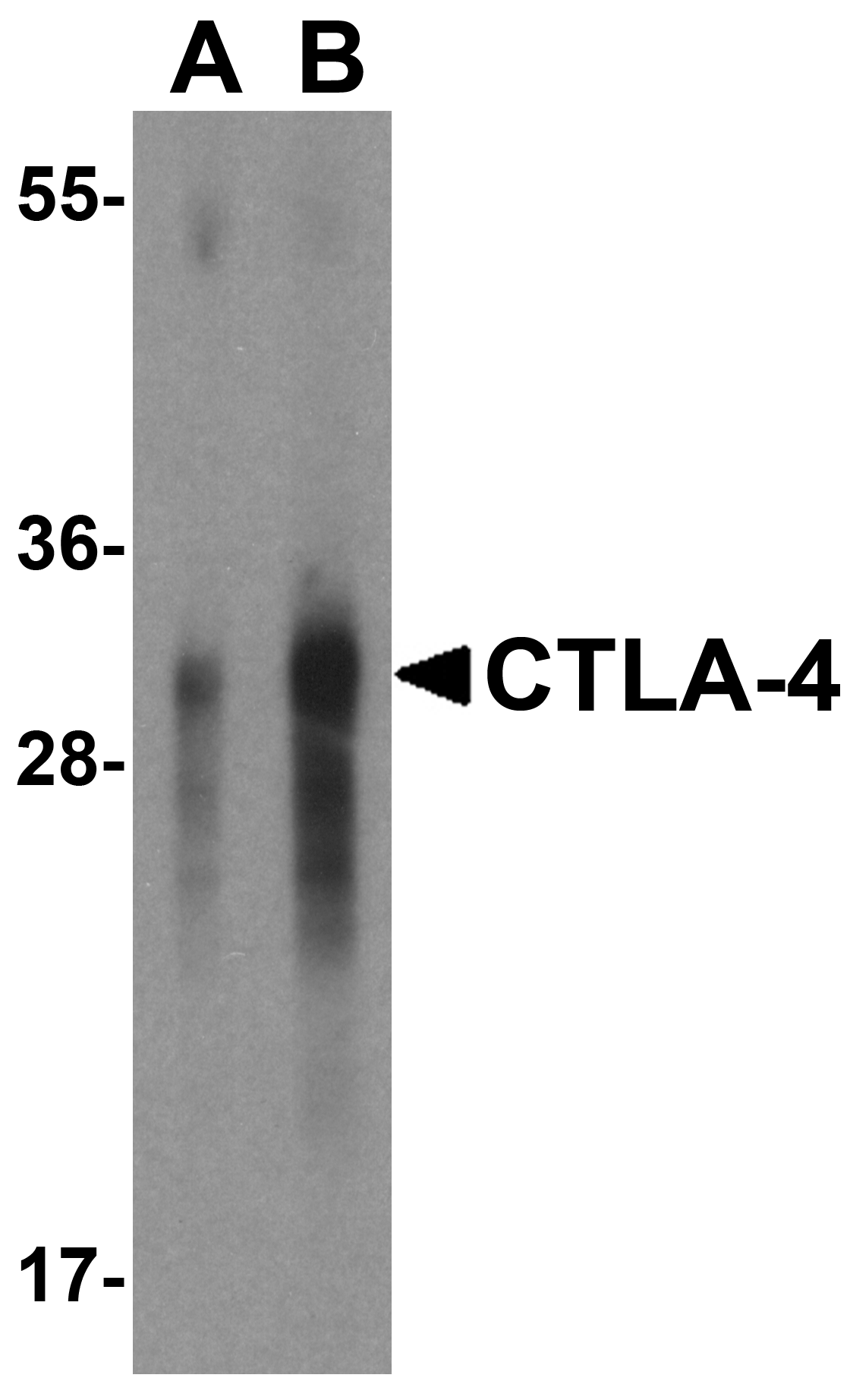 CTLA4 / CD152 Antibody (clone 8A1)