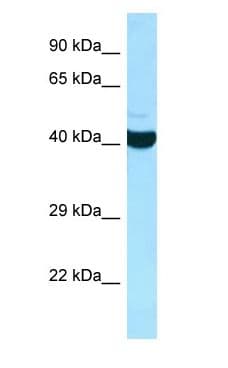 ADPRHL2 Antibody (aa228-277)