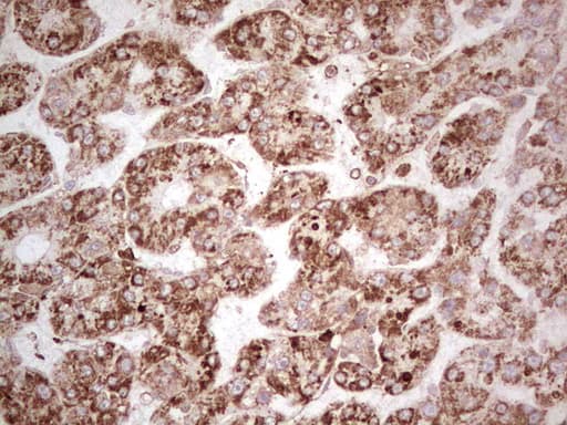 MTDH / Metadherin Antibody (aa70-582, clone OTI6H2)