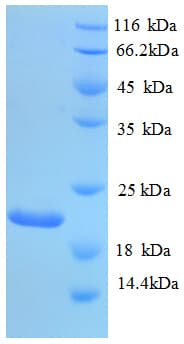 Human PLAU / Urokinase / uPA Protein (Recombinant His)