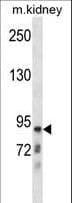 Polyclonal Rabbit anti-Human CLCNKB Antibody (aa11-40, WB)