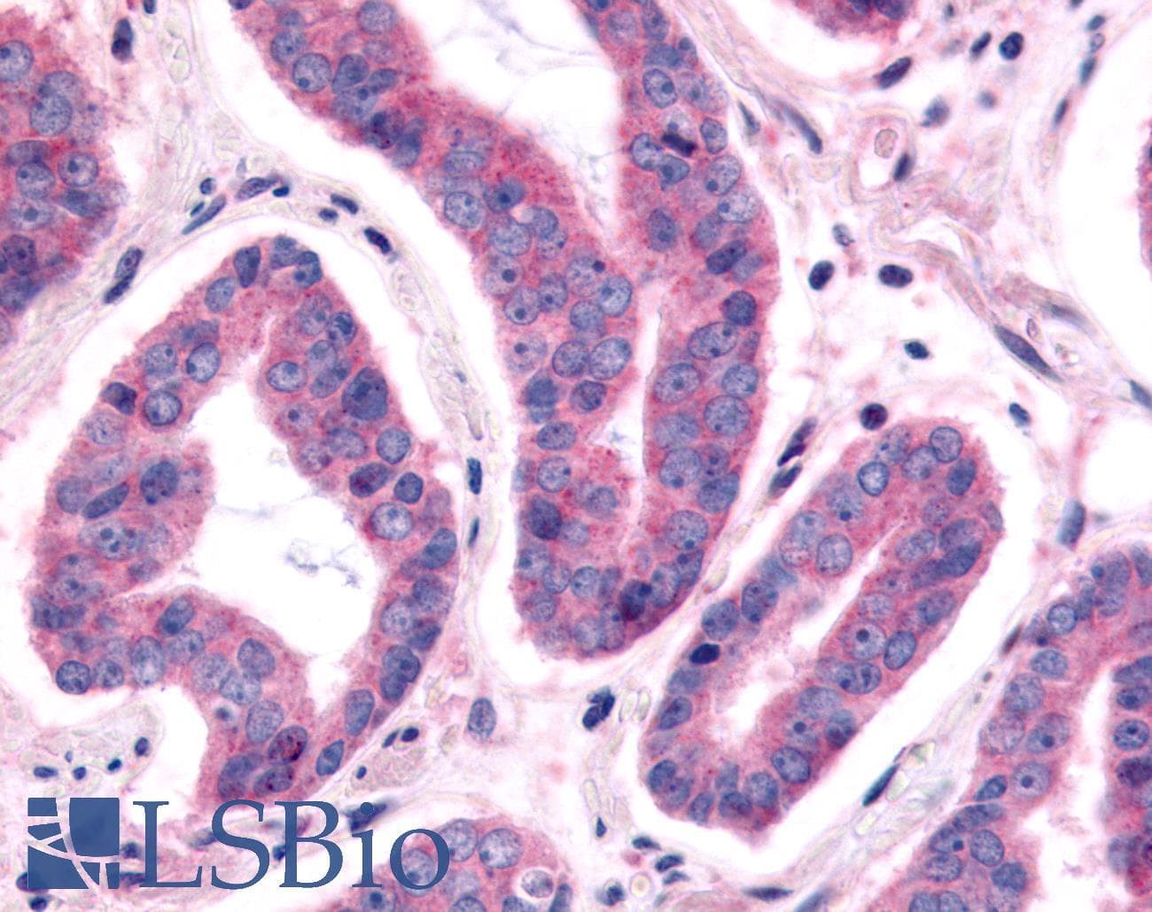 PathPlus™ Polyclonal Rabbit anti-Human NEK9 Antibody (Kinase Domain, IHC)