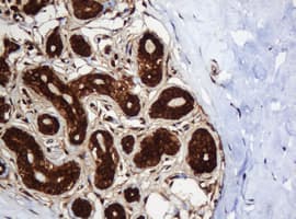 PAI-RBP1 / SERBP1 Antibody (aa1-262, clone OTI2C11)