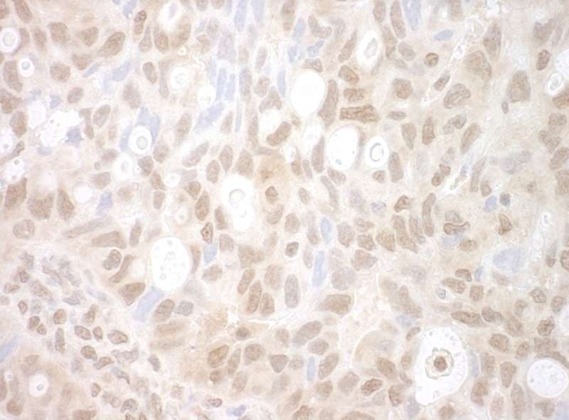 PHF20 Antibody (aa900-950)