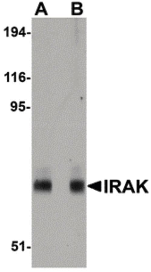 Monoclonal Mouse anti-Human IRAK1 / IRAK Antibody (clone 8F1A7, IHC, WB)