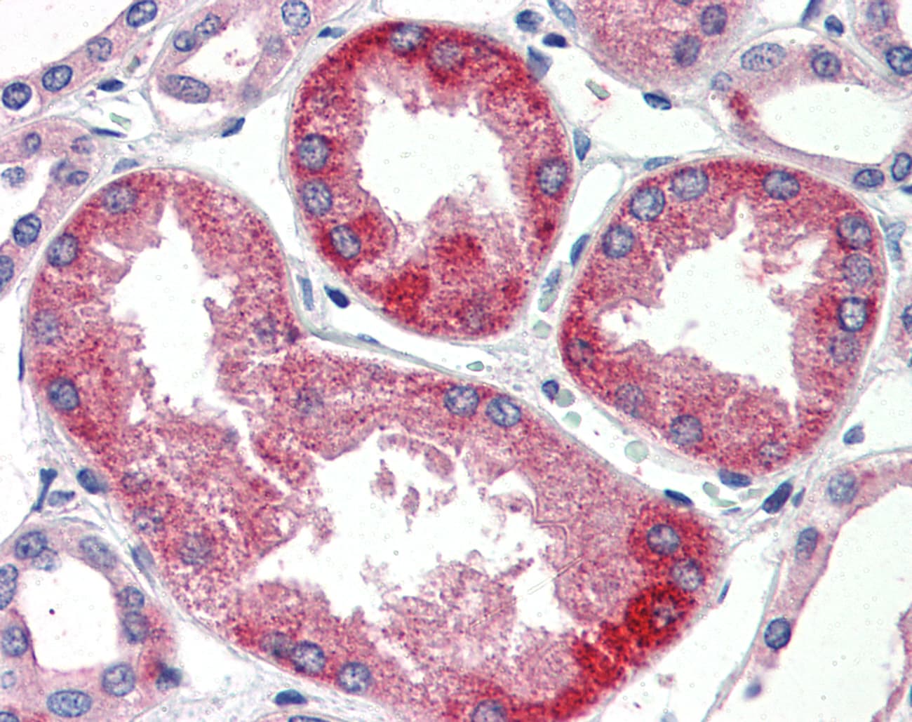 IHC-plus™ Polyclonal Rabbit anti-Human SURF4 Antibody (N-Terminus, IHC)
