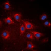 Polyclonal Rabbit anti-Human RPS20 / Ribosomal Protein S20 Antibody (Internal, IHC, IF, WB)
