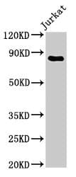 IHC-plus™ Polyclonal Rabbit anti-Human CD71 / Transferrin Receptor Antibody (aa 94-754, IHC, IF, WB)