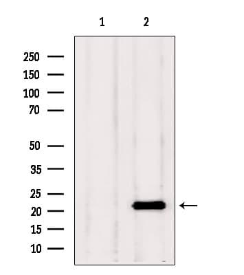 TAGLN2 / Transgelin 2 Antibody