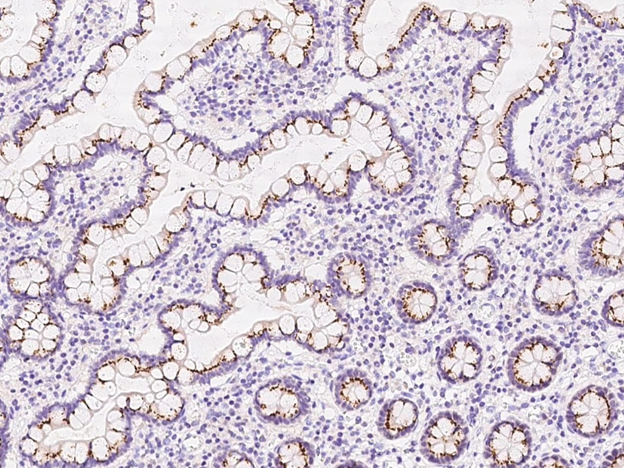 Polyclonal Rabbit anti-Human GALNT12 Antibody (IHC)