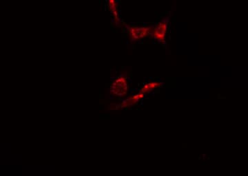 MAK Antibody