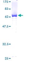 Human RCN1 / Reticulocalbin 1 Protein (Recombinant GST)