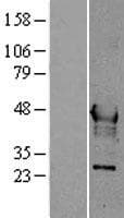 HPN / TMPRSS1 / Hepsin Protein (Over-Expression Lysate Myc-DDK (Flag))