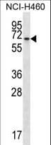 Polyclonal Rabbit anti-Human BEND4 Antibody (aa16-44, WB)