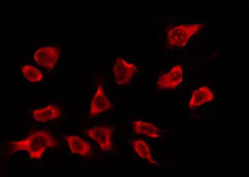 OR2A5+OR2A14 Antibody