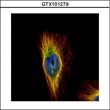 IHC-plus™ TUBB / Beta Tubulin Antibody (aa238-429)