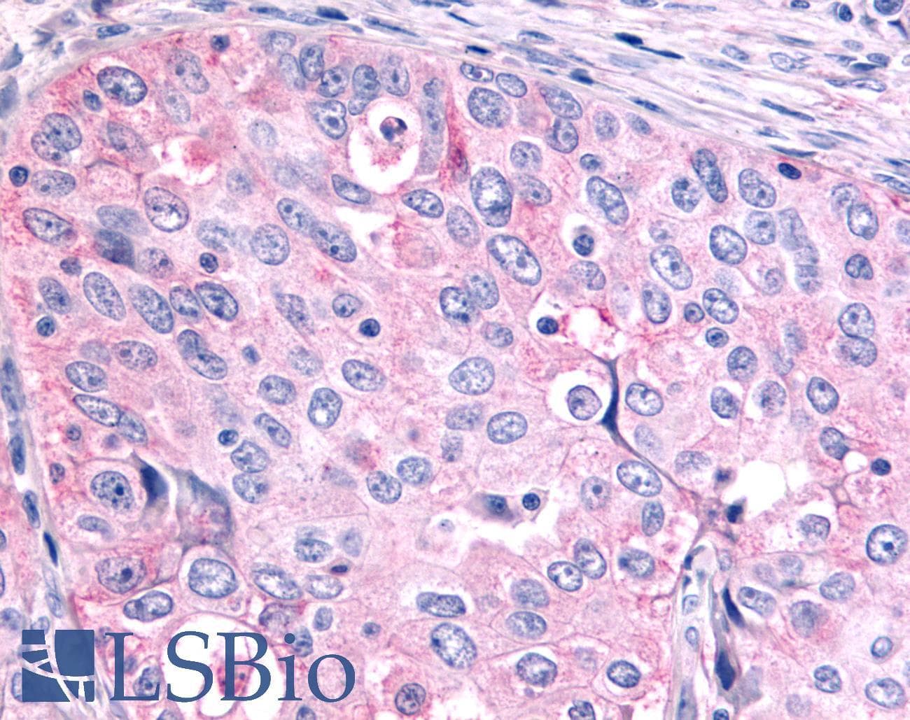 PathPlus™ Polyclonal Rabbit anti-Human NR6A1 / GCNF Antibody (Ligand-binding Domain, IHC)