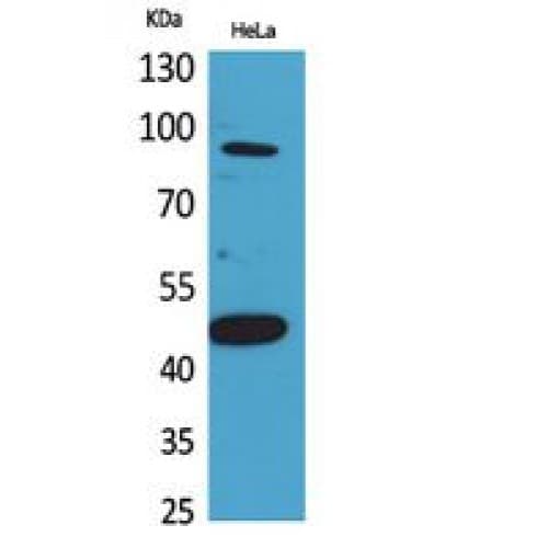 Polyclonal Rabbit anti-Human INHBB / Inhibin Beta B Antibody (351-400 aa, C-terminal, IHC, WB)