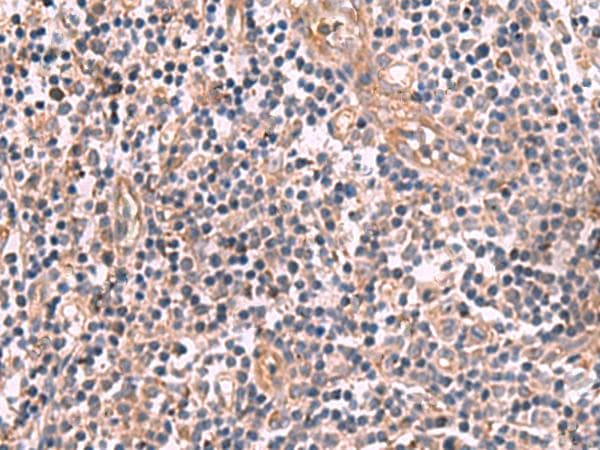 MGP / Matrix Gla-Protein Antibody