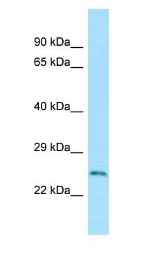 RAB5A / RAB5 Antibody (C-Terminus)