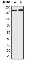 ARID1B / BAF250B Antibody (Internal)