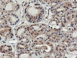 Monoclonal Mouse anti-Human FDFT1 / Squalene Synthase Antibody (clone OTI2F10, IHC, IF, WB)