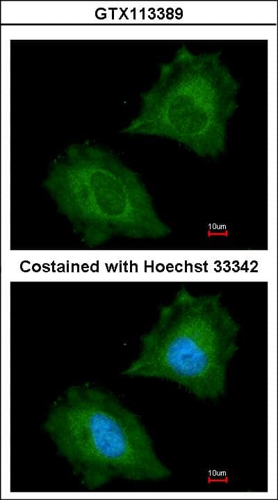 IHC-plus™ ASPA Antibody (aa39-300)