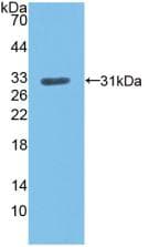 LDLR / LDL Receptor Antibody (aa497-742, PE)