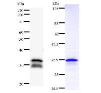 DDB2 Antibody (clone 2246C4a)